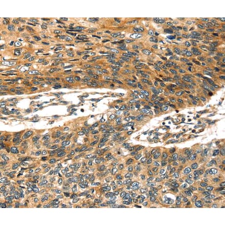 Immunohistochemistry - STX19 Antibody from Signalway Antibody (40343) - Antibodies.com