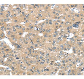 Immunohistochemistry - TUSC2 Antibody from Signalway Antibody (40349) - Antibodies.com