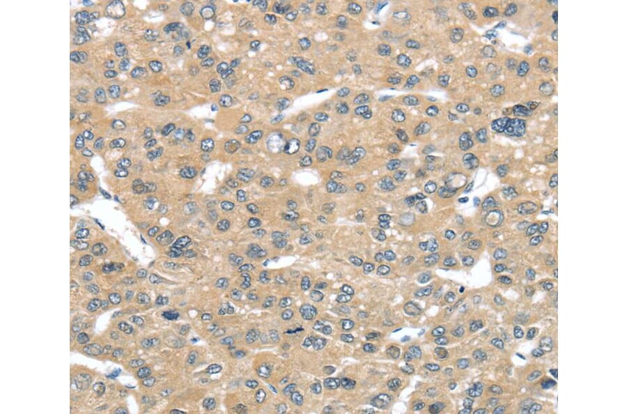 Immunohistochemistry - TUSC2 Antibody from Signalway Antibody (40349) - Antibodies.com