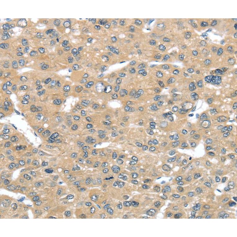 Immunohistochemistry - TUSC2 Antibody from Signalway Antibody (40349) - Antibodies.com