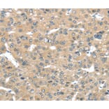 Immunohistochemistry - TUSC2 Antibody from Signalway Antibody (40349) - Antibodies.com