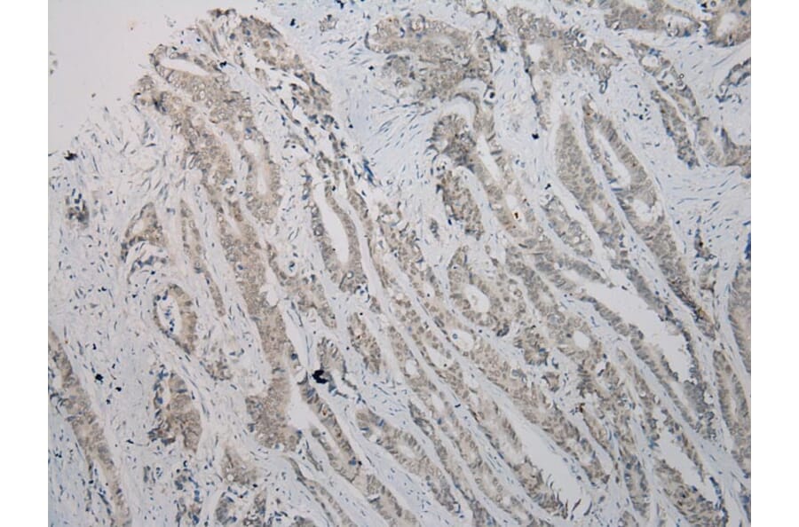 Immunohistochemistry - TBL1Y Antibody from Signalway Antibody (40352) - Antibodies.com