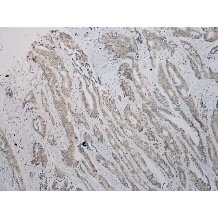 Immunohistochemistry - TBL1Y Antibody from Signalway Antibody (40352) - Antibodies.com