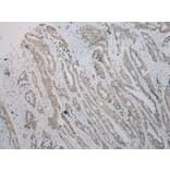 Immunohistochemistry - TBL1Y Antibody from Signalway Antibody (40352) - Antibodies.com