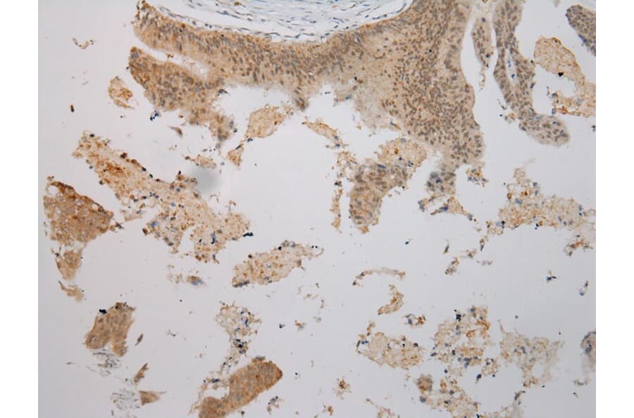 Immunohistochemistry - TBL1Y Antibody from Signalway Antibody (40352) - Antibodies.com