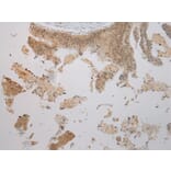 Immunohistochemistry - TBL1Y Antibody from Signalway Antibody (40352) - Antibodies.com