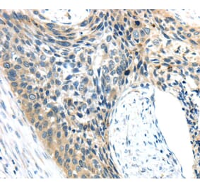 Immunohistochemistry - AEBP1 Antibody from Signalway Antibody (40358) - Antibodies.com