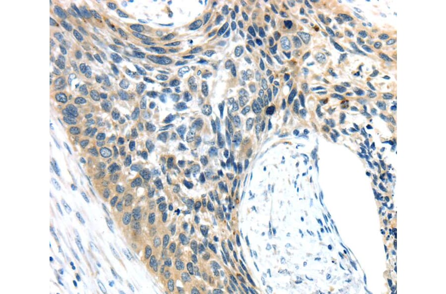 Immunohistochemistry - AEBP1 Antibody from Signalway Antibody (40358) - Antibodies.com
