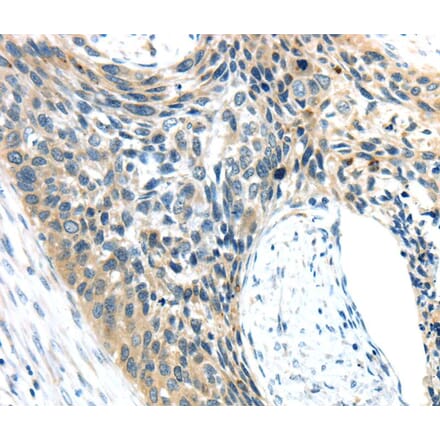 Immunohistochemistry - AEBP1 Antibody from Signalway Antibody (40358) - Antibodies.com
