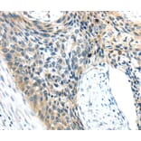 Immunohistochemistry - AEBP1 Antibody from Signalway Antibody (40358) - Antibodies.com