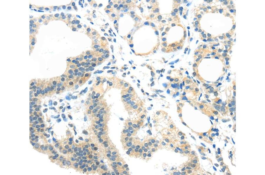 Immunohistochemistry - AEBP1 Antibody from Signalway Antibody (40358) - Antibodies.com