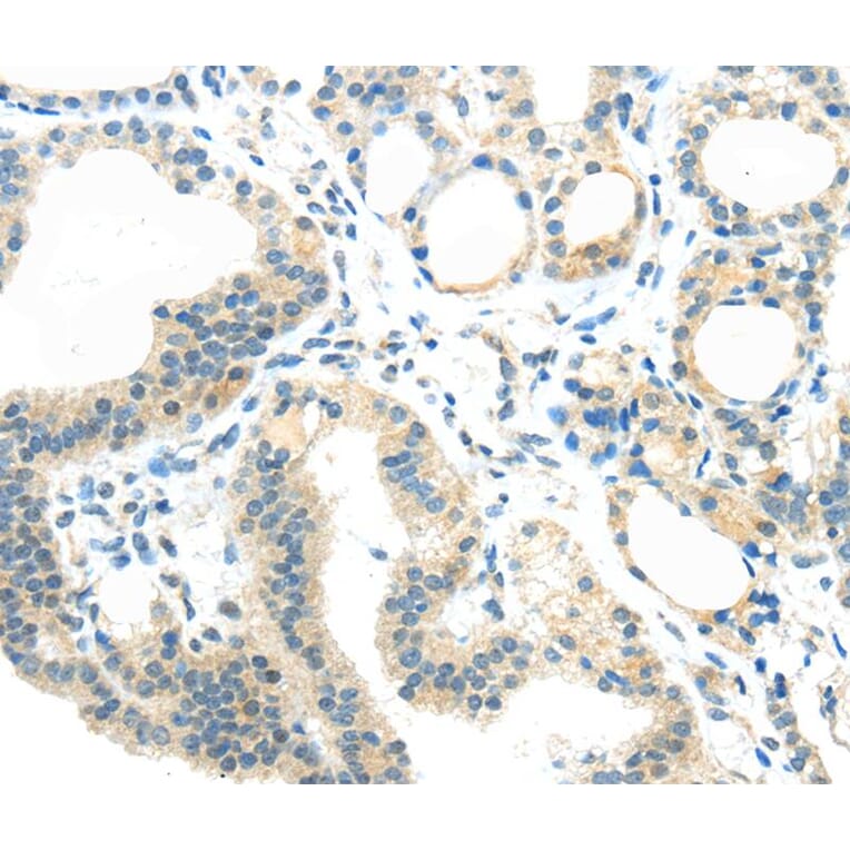 Immunohistochemistry - AEBP1 Antibody from Signalway Antibody (40358) - Antibodies.com