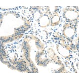 Immunohistochemistry - AEBP1 Antibody from Signalway Antibody (40358) - Antibodies.com