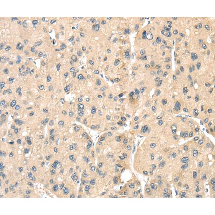 Immunohistochemistry - LOXL3 Antibody from Signalway Antibody (40361) - Antibodies.com