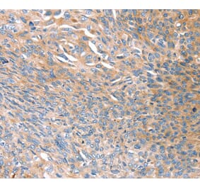 Immunohistochemistry - PRSS8 Antibody from Signalway Antibody (40367) - Antibodies.com