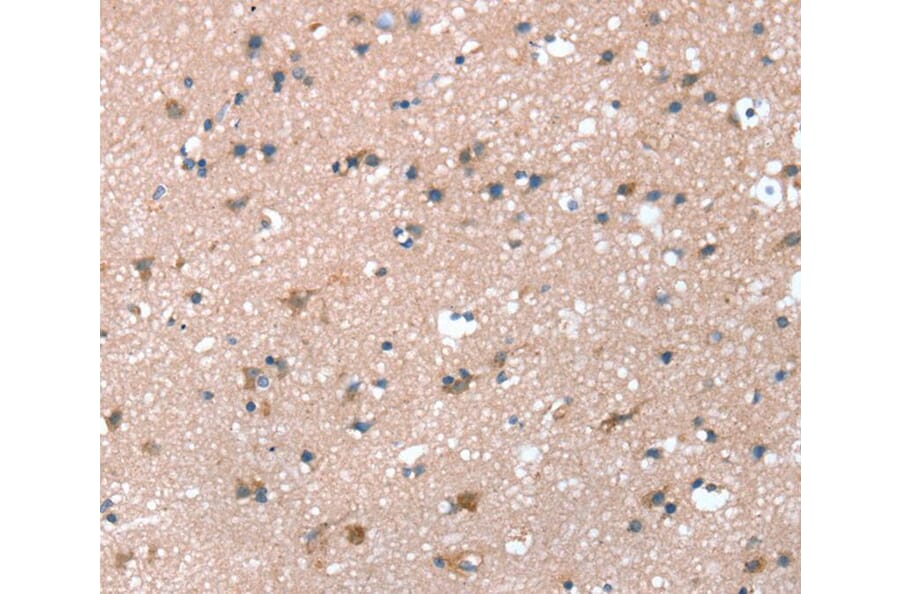 Immunohistochemistry - PRSS8 Antibody from Signalway Antibody (40367) - Antibodies.com