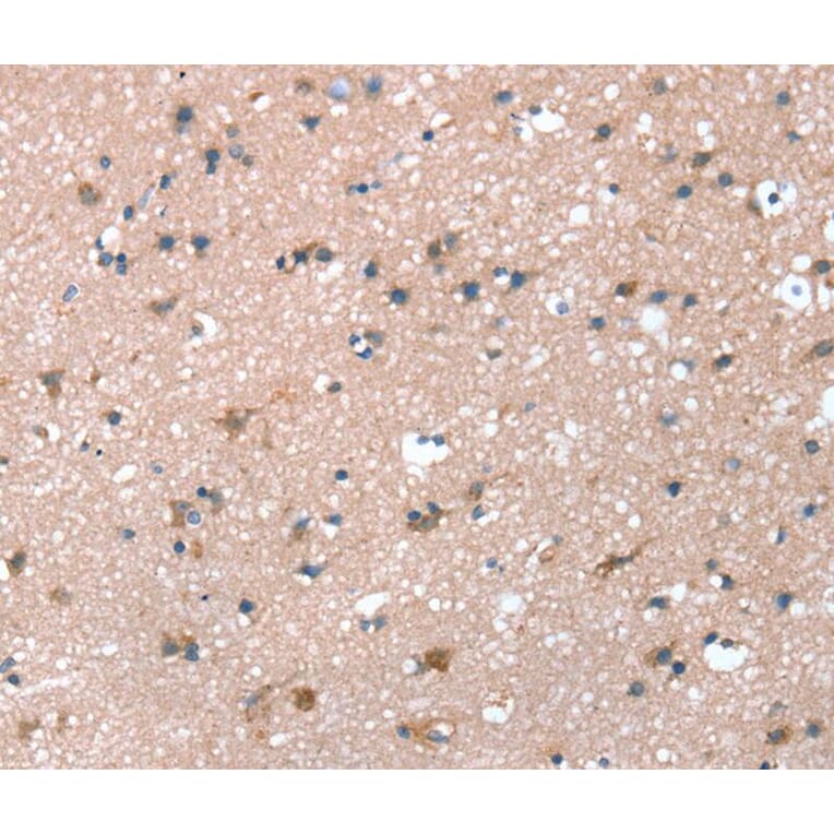 Immunohistochemistry - PRSS8 Antibody from Signalway Antibody (40367) - Antibodies.com