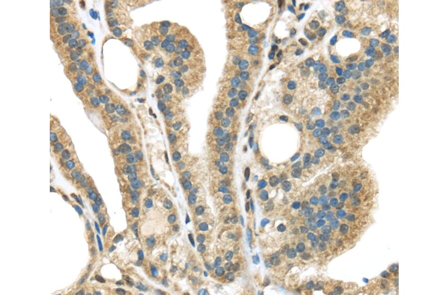 Immunohistochemistry - STK35 Antibody from Signalway Antibody (40376) - Antibodies.com