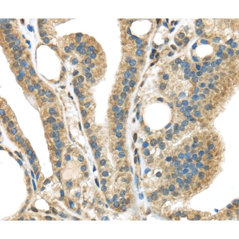 Immunohistochemistry - STK35 Antibody from Signalway Antibody (40376) - Antibodies.com