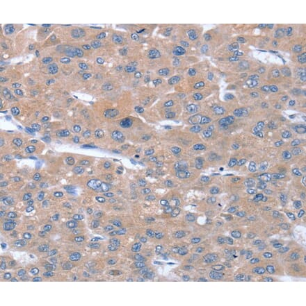 Immunohistochemistry - SULF1 Antibody from Signalway Antibody (40377) - Antibodies.com