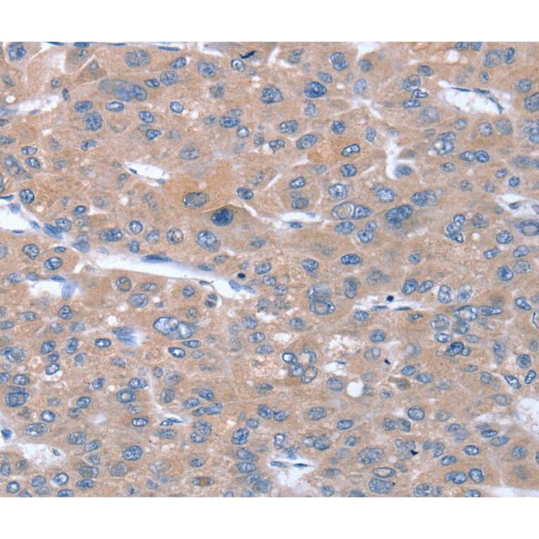 Immunohistochemistry - SULF1 Antibody from Signalway Antibody (40377) - Antibodies.com
