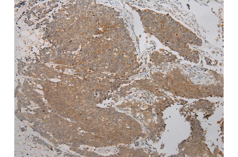 Immunohistochemistry - TPST2 Antibody from Signalway Antibody (40389) - Antibodies.com