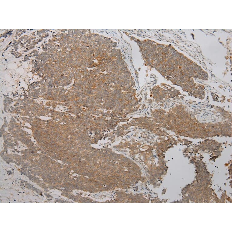 Immunohistochemistry - TPST2 Antibody from Signalway Antibody (40389) - Antibodies.com