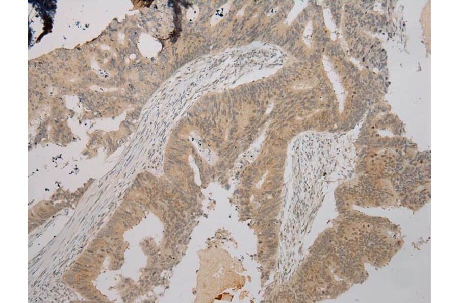 Immunohistochemistry - TPST2 Antibody from Signalway Antibody (40389) - Antibodies.com