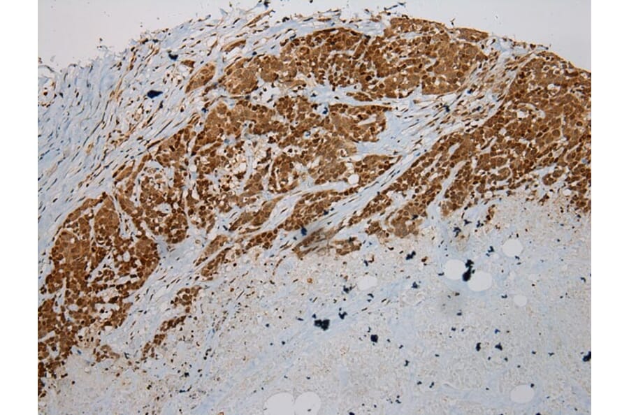 Immunohistochemistry - ULBP1 Antibody from Signalway Antibody (40399) - Antibodies.com