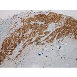 Immunohistochemistry - ULBP1 Antibody from Signalway Antibody (40399) - Antibodies.com