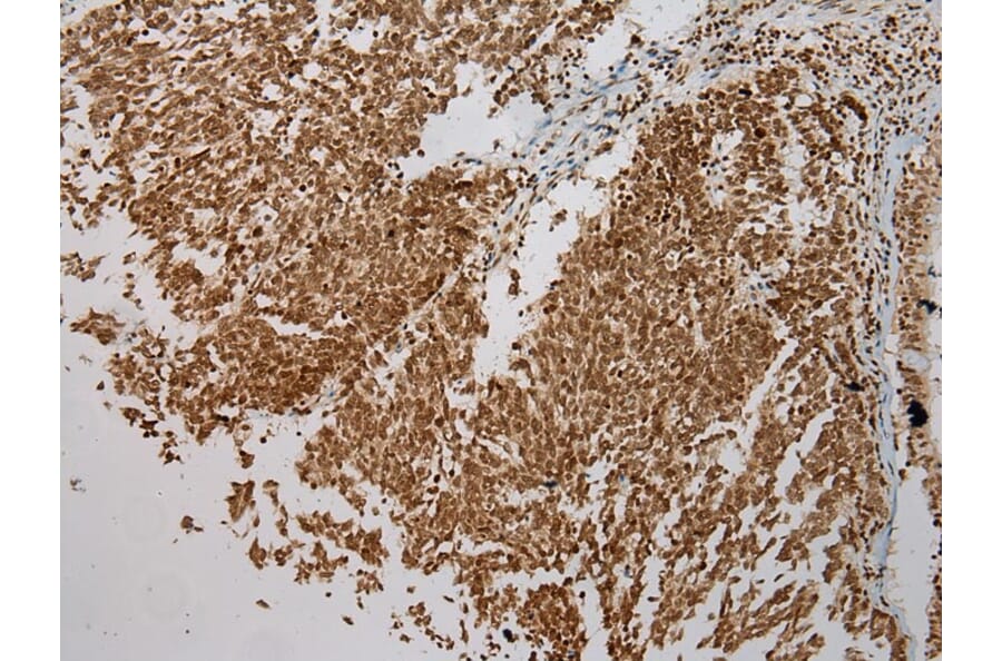 Immunohistochemistry - ULBP1 Antibody from Signalway Antibody (40399) - Antibodies.com
