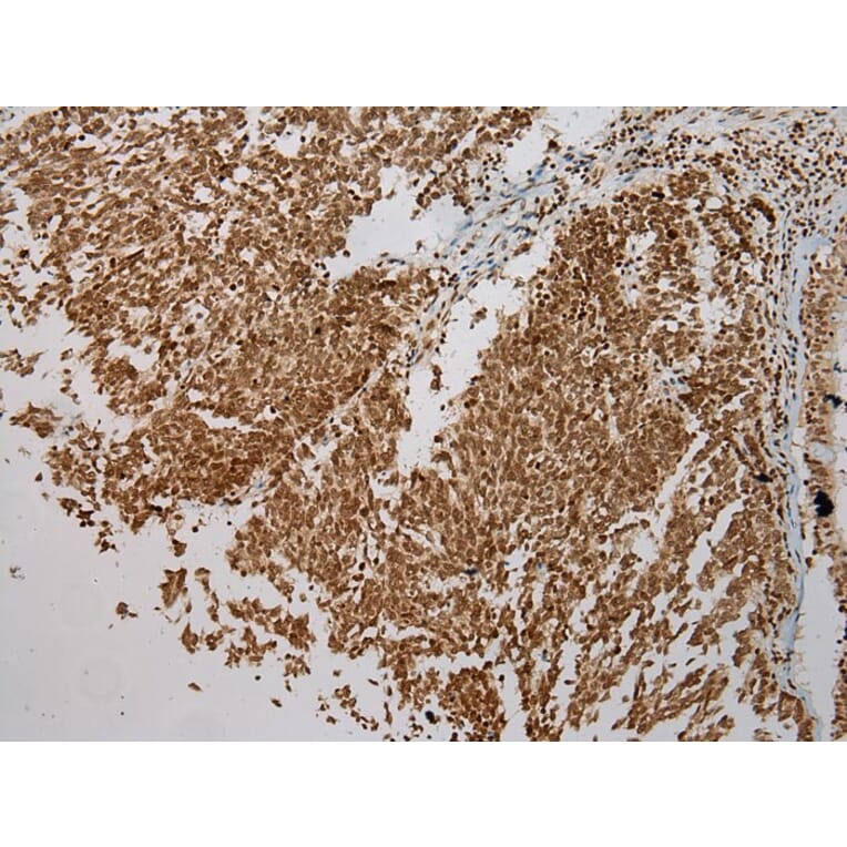 Immunohistochemistry - ULBP1 Antibody from Signalway Antibody (40399) - Antibodies.com