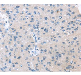 Immunohistochemistry - VPS4B Antibody from Signalway Antibody (40402) - Antibodies.com