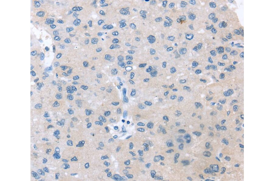 Immunohistochemistry - VPS4B Antibody from Signalway Antibody (40402) - Antibodies.com