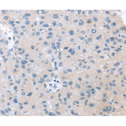 Immunohistochemistry - VPS4B Antibody from Signalway Antibody (40402) - Antibodies.com