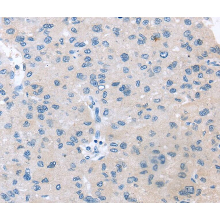 Immunohistochemistry - VPS4B Antibody from Signalway Antibody (40402) - Antibodies.com
