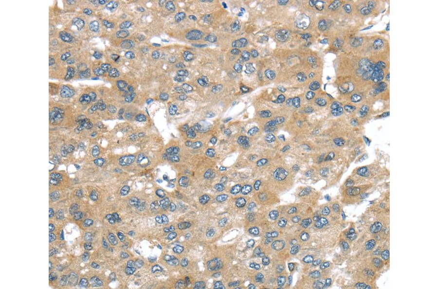 Immunohistochemistry - BRWD1 Antibody from Signalway Antibody (40404) - Antibodies.com