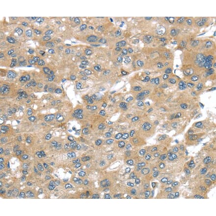 Immunohistochemistry - BRWD1 Antibody from Signalway Antibody (40404) - Antibodies.com