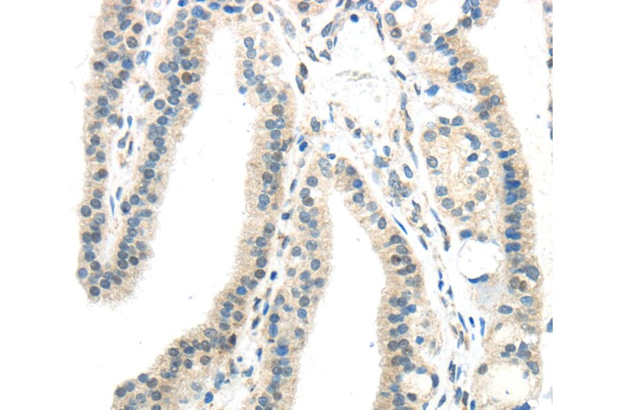 Immunohistochemistry - IL12A Antibody from Signalway Antibody (40406) - Antibodies.com