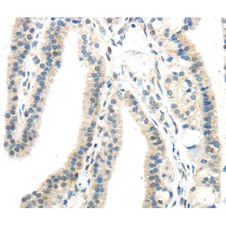 Immunohistochemistry - IL12A Antibody from Signalway Antibody (40406) - Antibodies.com