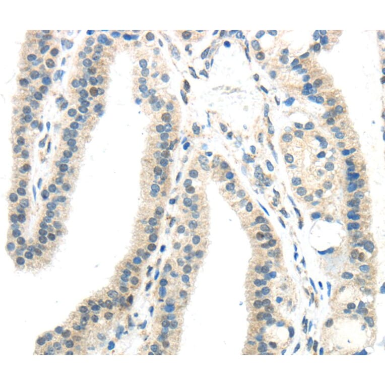 Immunohistochemistry - IL12A Antibody from Signalway Antibody (40406) - Antibodies.com