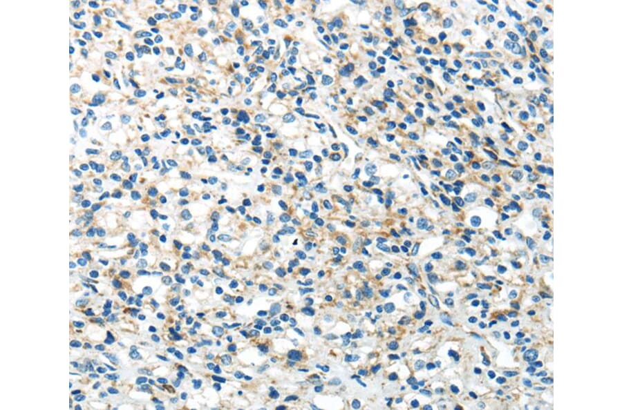 Immunohistochemistry - IL12A Antibody from Signalway Antibody (40406) - Antibodies.com