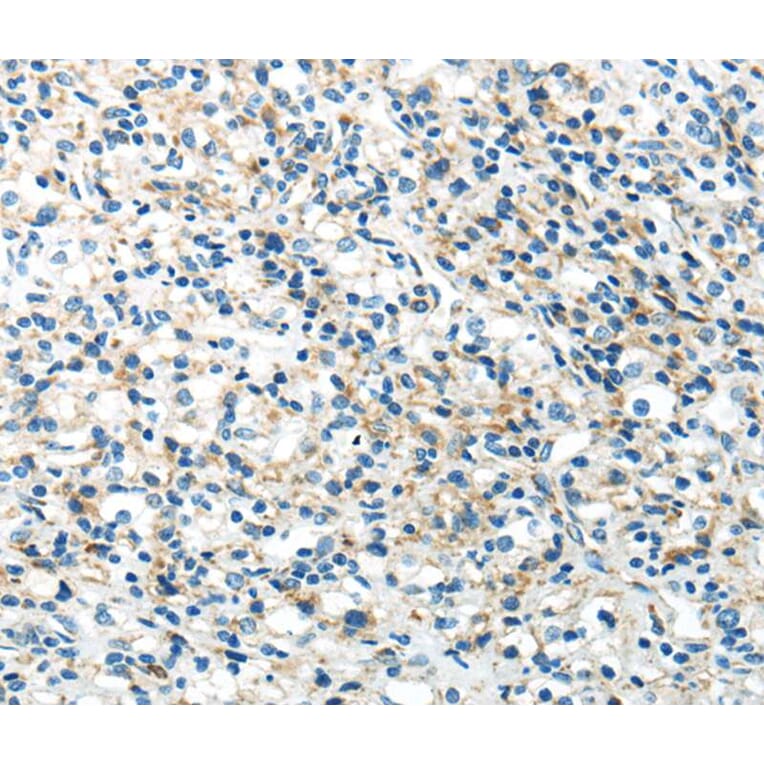 Immunohistochemistry - IL12A Antibody from Signalway Antibody (40406) - Antibodies.com