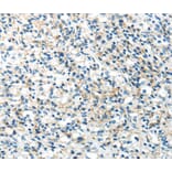Immunohistochemistry - IL12A Antibody from Signalway Antibody (40406) - Antibodies.com