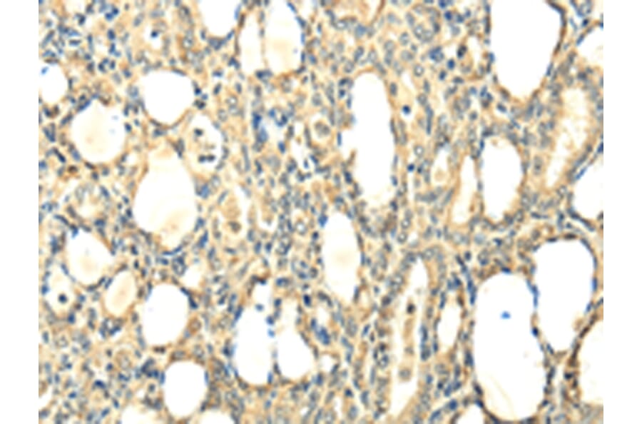Immunohistochemistry - CCL25 Antibody from Signalway Antibody (42700) - Antibodies.com