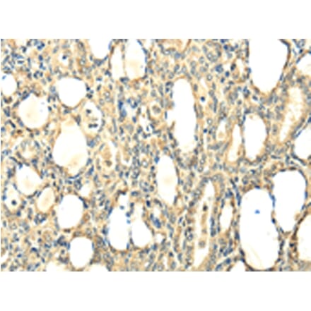 Immunohistochemistry - CCL25 Antibody from Signalway Antibody (42700) - Antibodies.com