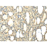 Immunohistochemistry - CCL25 Antibody from Signalway Antibody (42700) - Antibodies.com