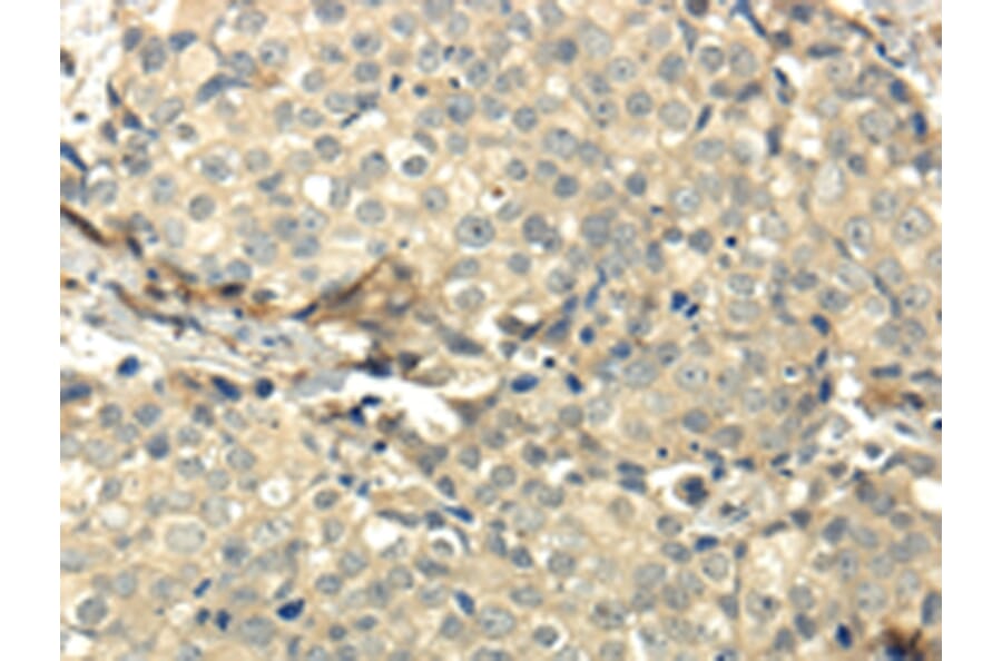 Immunohistochemistry - CCL25 Antibody from Signalway Antibody (42700) - Antibodies.com