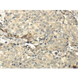 Immunohistochemistry - CCL25 Antibody from Signalway Antibody (42700) - Antibodies.com