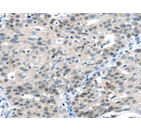 Immunohistochemistry - CCNA1 Antibody from Signalway Antibody (42702) - Antibodies.com